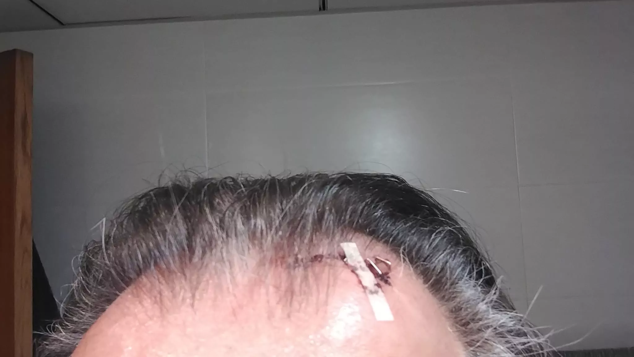 Un hombre que se dirigía a su casa fue alcanzado por una teja.